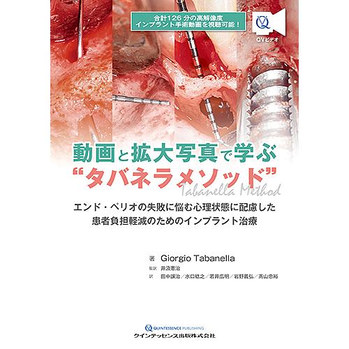 動画と拡大写真で学ぶ タバネラメソッド エンド・ペリオの失敗に悩む心理状態に配慮した患者負担軽減のためのインプラント治療