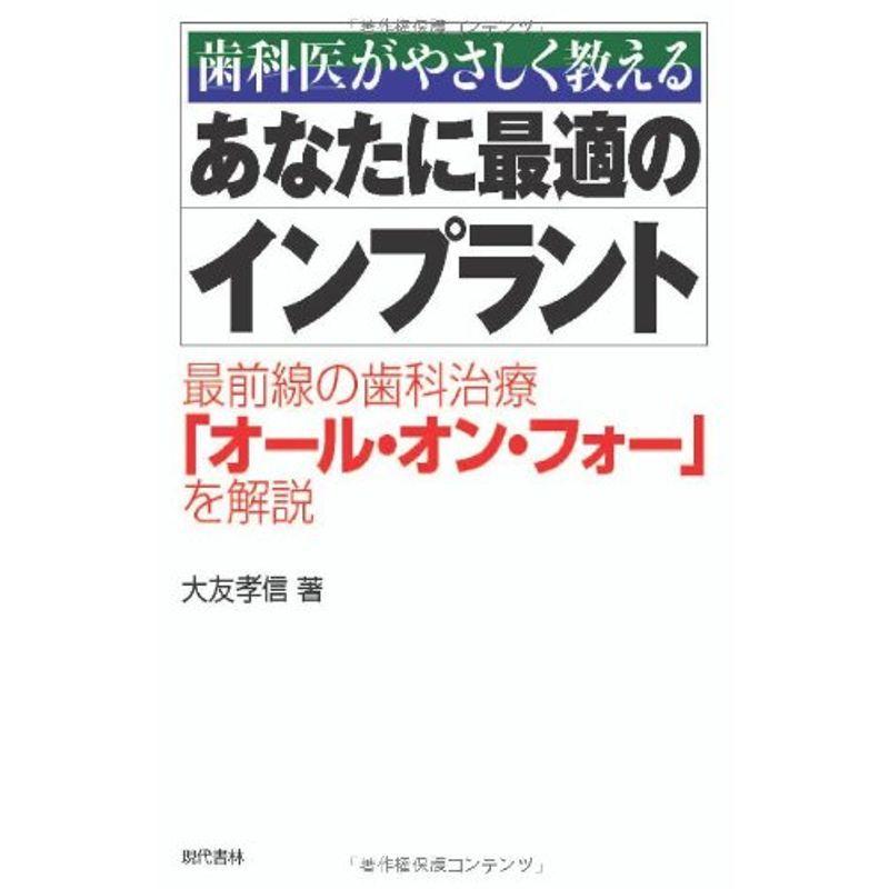 あなたに最適のインプラント ?歯科医がやさしく教える