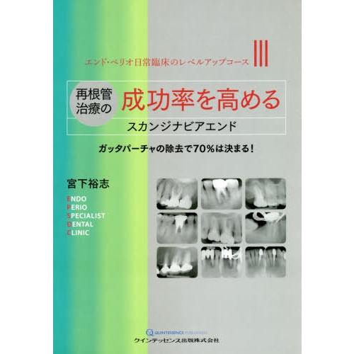 再根管治療の成功率を高めるスカンジナビアエンド ガッタパーチャの除去で70%は決まる