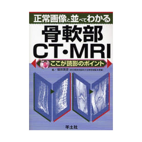 正常画像と並べてわかる骨軟部CT・MRI ここが読影のポイント