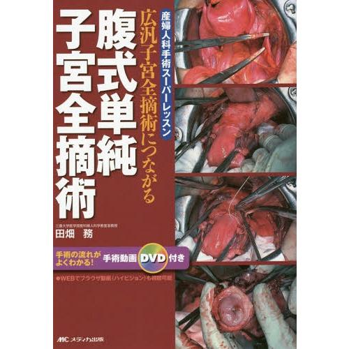 [本 雑誌] 腹式単純子宮全摘術 広汎子宮全摘術につながる 産婦人科手術スーパーレッスン 田畑務 著