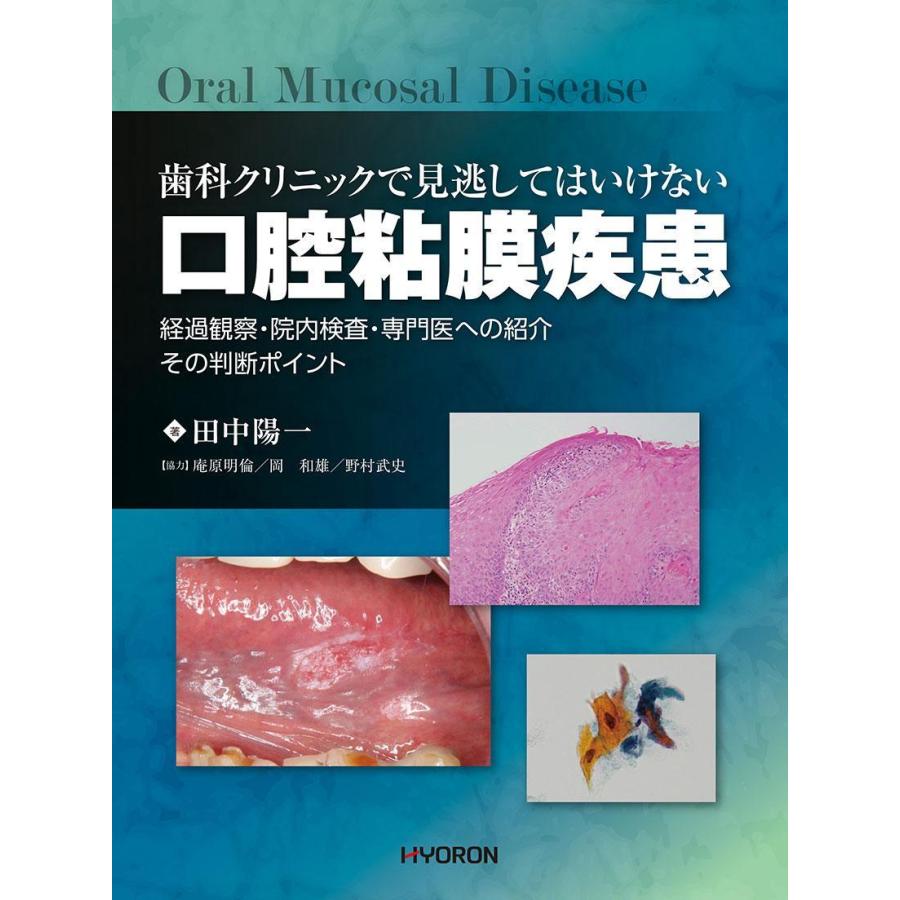 歯科クリニックで見逃してはいけない 口腔粘膜疾患