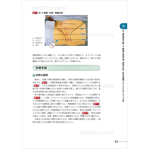 究める 腎・副腎腫瘍に対する腹腔鏡・ロボット支援手術