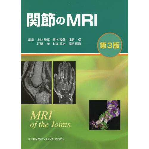 関節のMRI