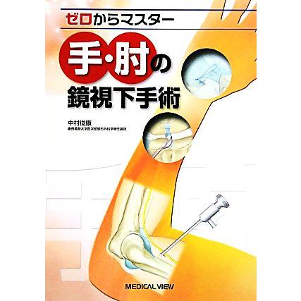 手・肘の鏡視下手術 ゼロからマスター／中村俊康