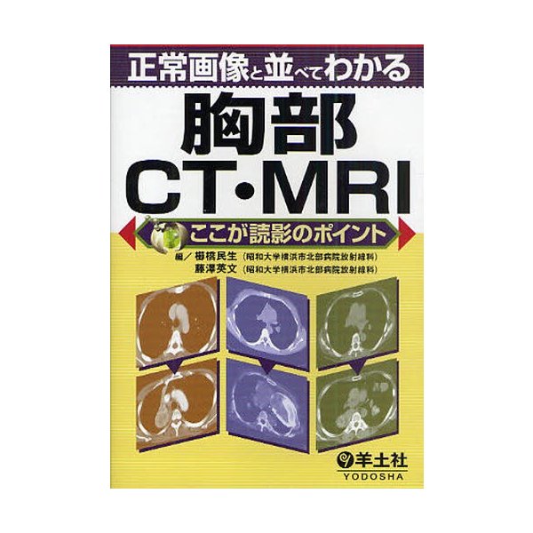 正常画像と並べてわかる胸部CT・MRI