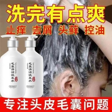🔥熱銷🔥仁和匠心同款止/癢洗髮精 清爽控油蓬鬆洗髮 毛囊清潔洗髮水 大容量380ml 洗髮精 控油 蓬鬆洗髮 控油洗
