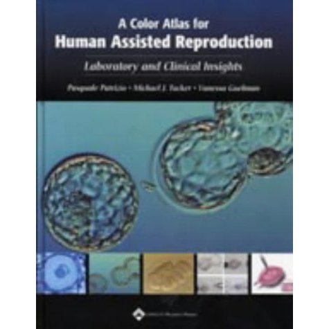 A Color Atlas for Human Assisted Reproduction