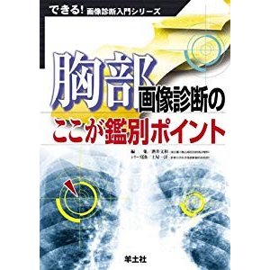 胸部画像診断のここが鑑別ポイント (できる!画像診断入門シリーズ)