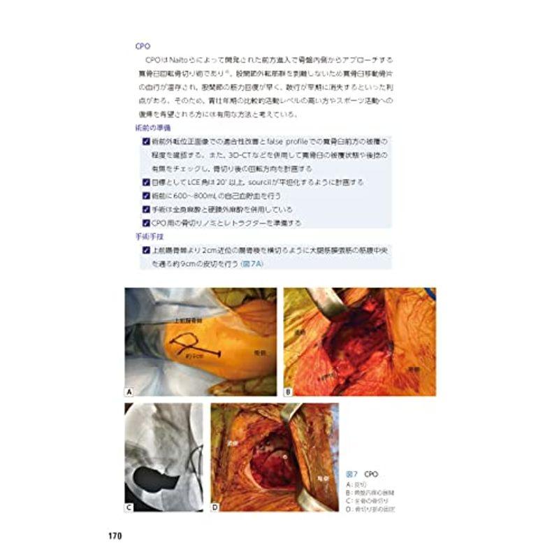 整形外科医のための 股関節のスポーツ診療のすべて