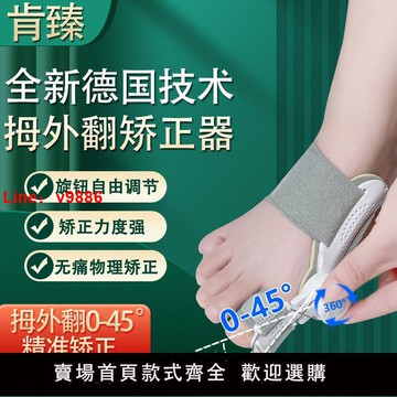 【台灣公司保固】拇外翻腳趾矯正器糾正大腳骨腳趾頭拇指重疊分離夜用旋鈕式可調式