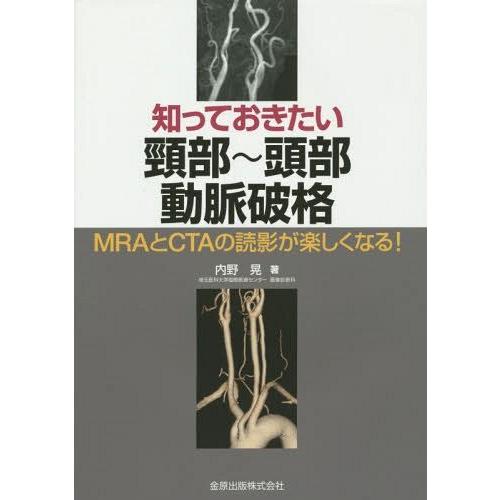 知っておきたい頸部~頭部動脈破格 MRAとCTAの読影が楽しくなる