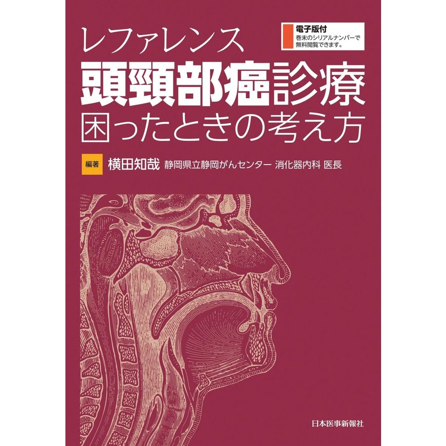 レファレンス頭頚部癌診療困ったときの考え方