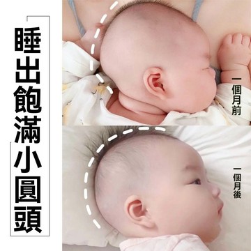 🔥【台灣出貨】嬰兒定型枕 寶寶頭型枕 立體枕 新生兒0到1嵗-6個月糾正偏頭枕頭 防偏頭定型枕 新生兒枕 凹洞枕 矯正枕