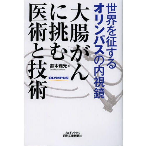 大腸がんに挑む医術と技術 世界を征するオリンパスの内視鏡