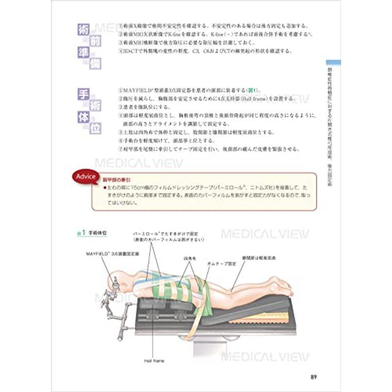 脊椎 (新 執刀医のためのサージカルテクニック)