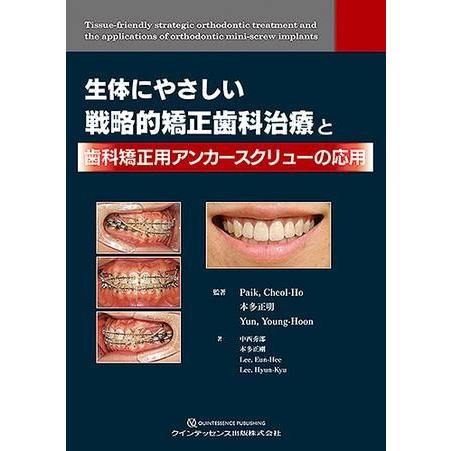 生体にやさしい戦略的矯正歯科治療と 歯科矯正用アンカースクリューの応用 クインテッセンス出版