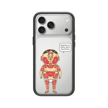 iPhone 17 Pro Max Mod NX -邊框背蓋組合 (相機按鈕) 黑 - 保羅先生 Mr.Paul - 圖解人體部位