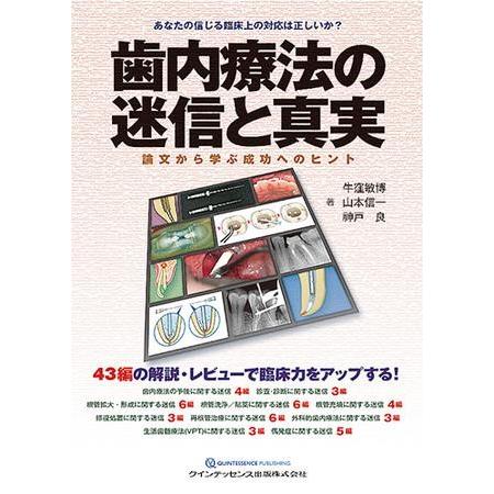 歯内療法の迷信と真実