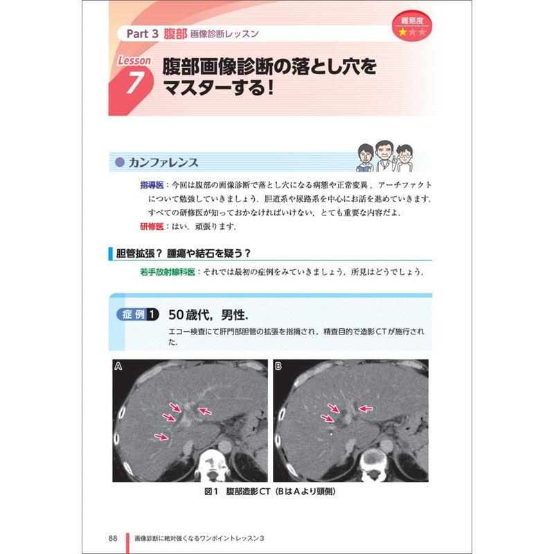 画像診断に絶対強くなるワンポイントレッスン3〜何ひとつ見逃さないための読影のポイント