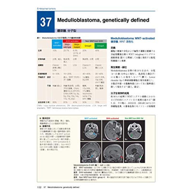 脳腫瘍臨床病理カラーアトラス 第4版