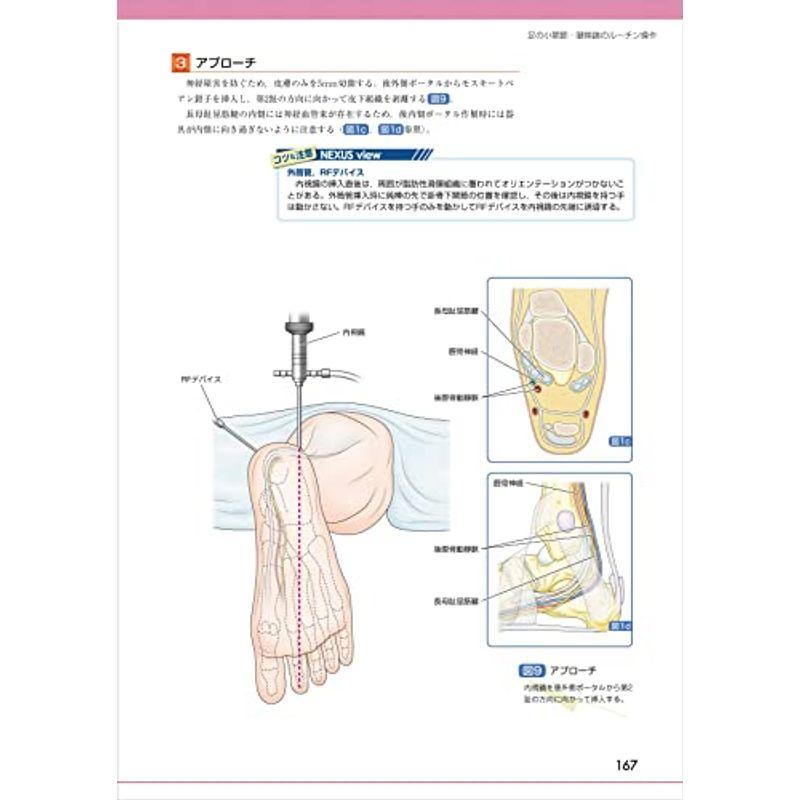 関節鏡手術の基本−ルーチン操作とデバイスの扱い方 (OS NEXUS（電子版付き） 20)