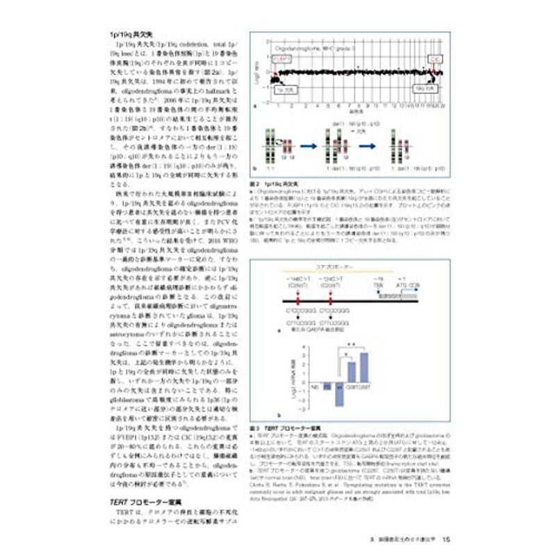 脳腫瘍臨床病理カラーアトラス 第4版