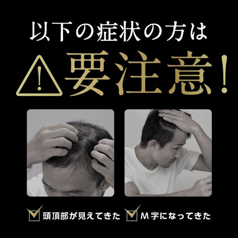 ミノキシジル5%配合 「ミノカミング 60ml 」【第1類医薬品】 国内最大量 発毛剤 育毛剤 男性用 抜け毛予防 薬剤師対応 |  LINEブランドカタログ