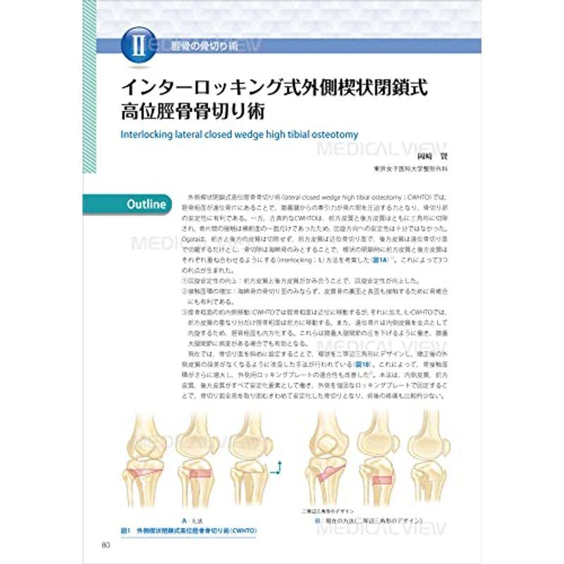 膝周囲骨切り術のすべて