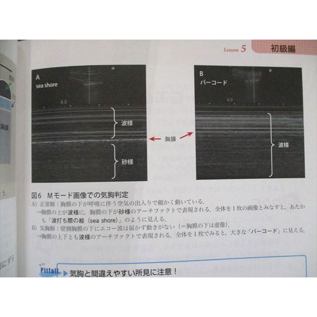 US82-283 羊土社 あてて見るだけ! 劇的! 救急エコー塾 13m3C