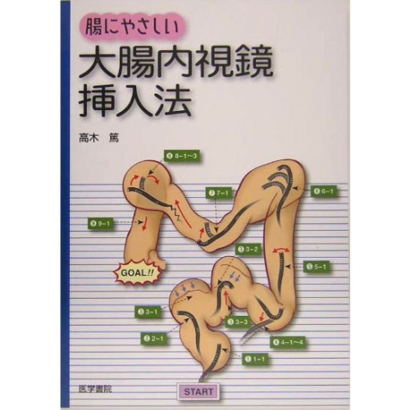 腸にやさしい大腸内視鏡挿入法