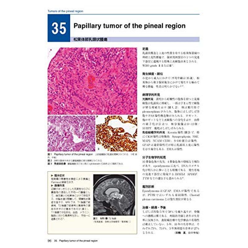 脳腫瘍臨床病理カラーアトラス 第4版