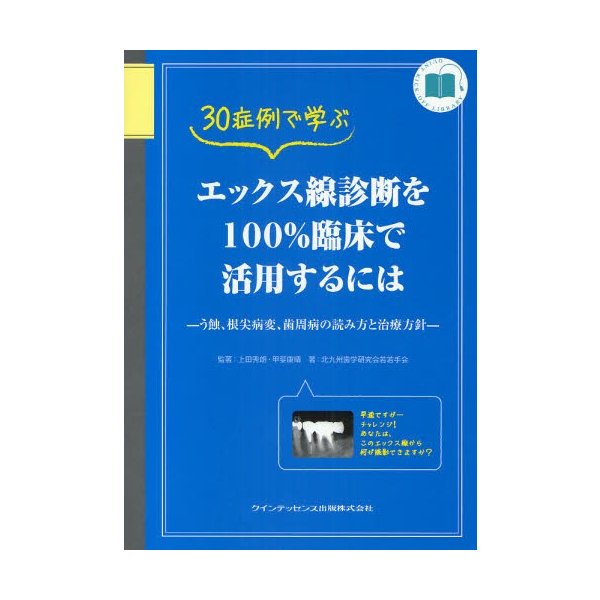 30症例で学ぶエックス線診断を100%臨床で活用するには う蝕,根尖病変,歯周病の読み方と治療方針